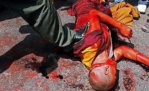 A brutalized Tibetan protester.