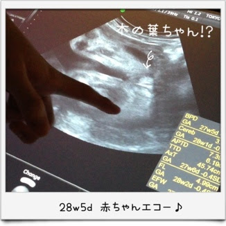赤ちゃん28w5d