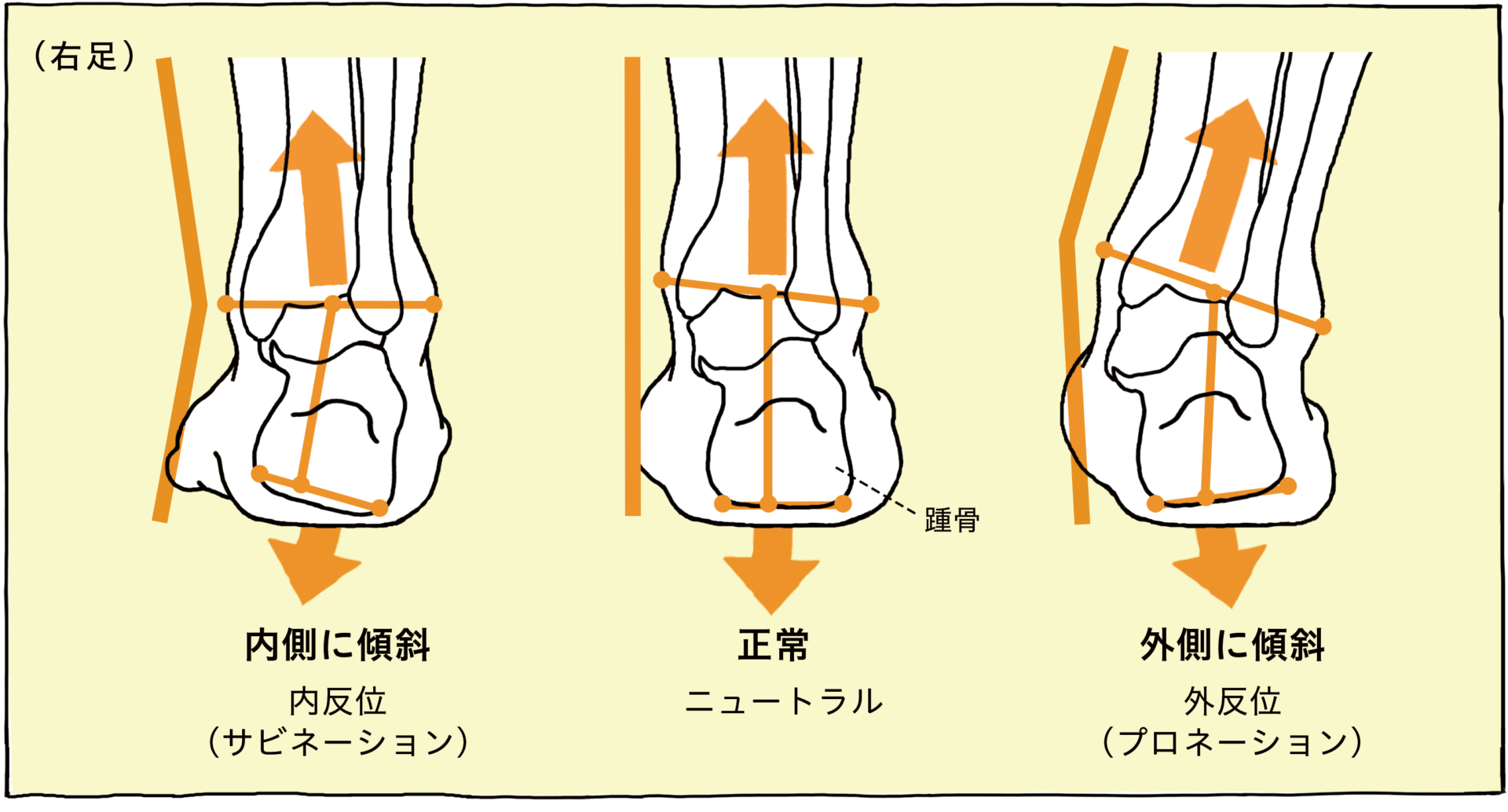 足首が痛い 原因 と 場所 から分類 解説 対処法 足のお悩み百科