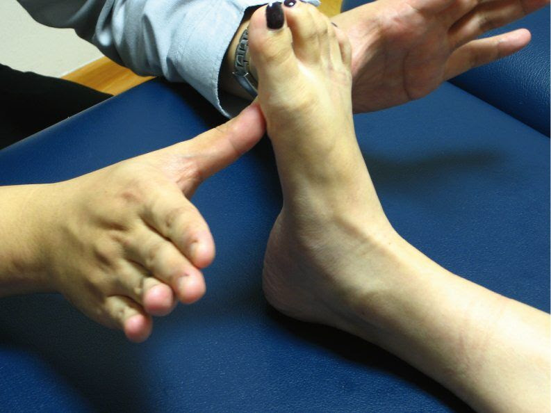 plantar fasciitis taping. this sports taping series.