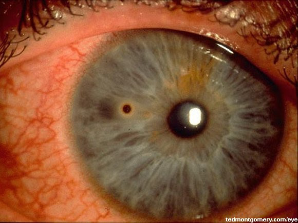 eyelid tattoo