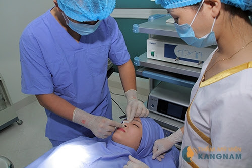 Thế nào là nâng mũi Hàn Quốc? - Chuyên gia 