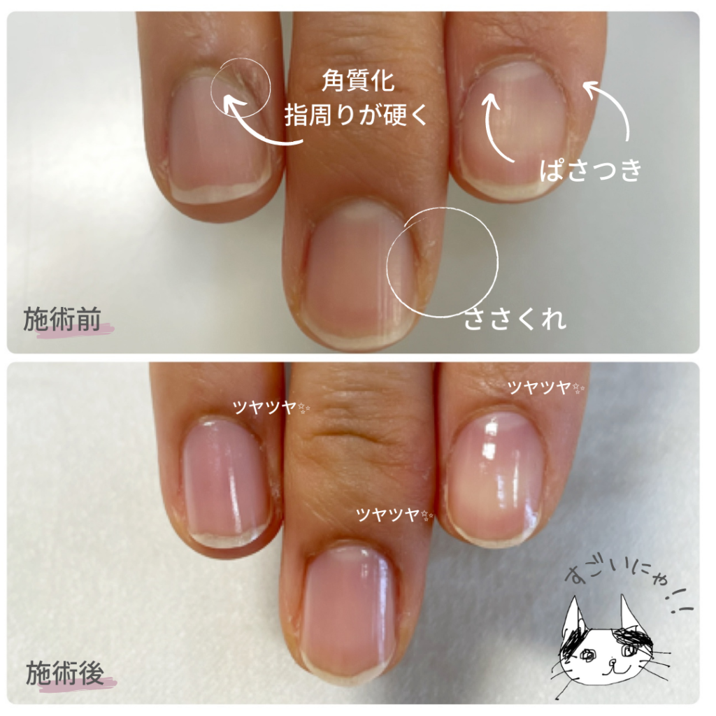 自爪育成１ヶ月の効果 さいたま新都心 ネイルケアと自爪育成 が得意なサロン Panconail パンコネイル 埼玉 自爪育成とネイルケアが得意なサロン