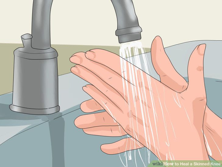 Heal a Skinned Knee Step 2 Version 4.jpg