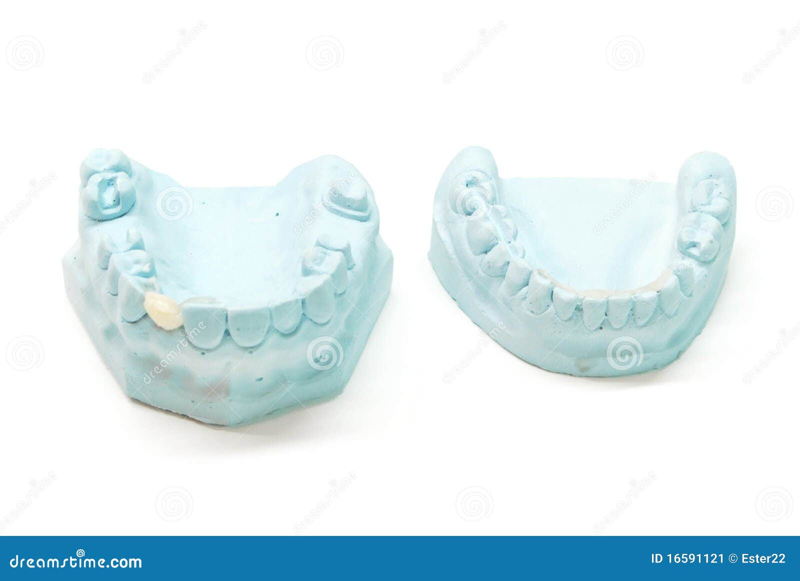 Gypsum Model Of Human Teeth Stock Image Image 16591121 Gypsum Model Of Human Teeth Stock Image Image 16591121