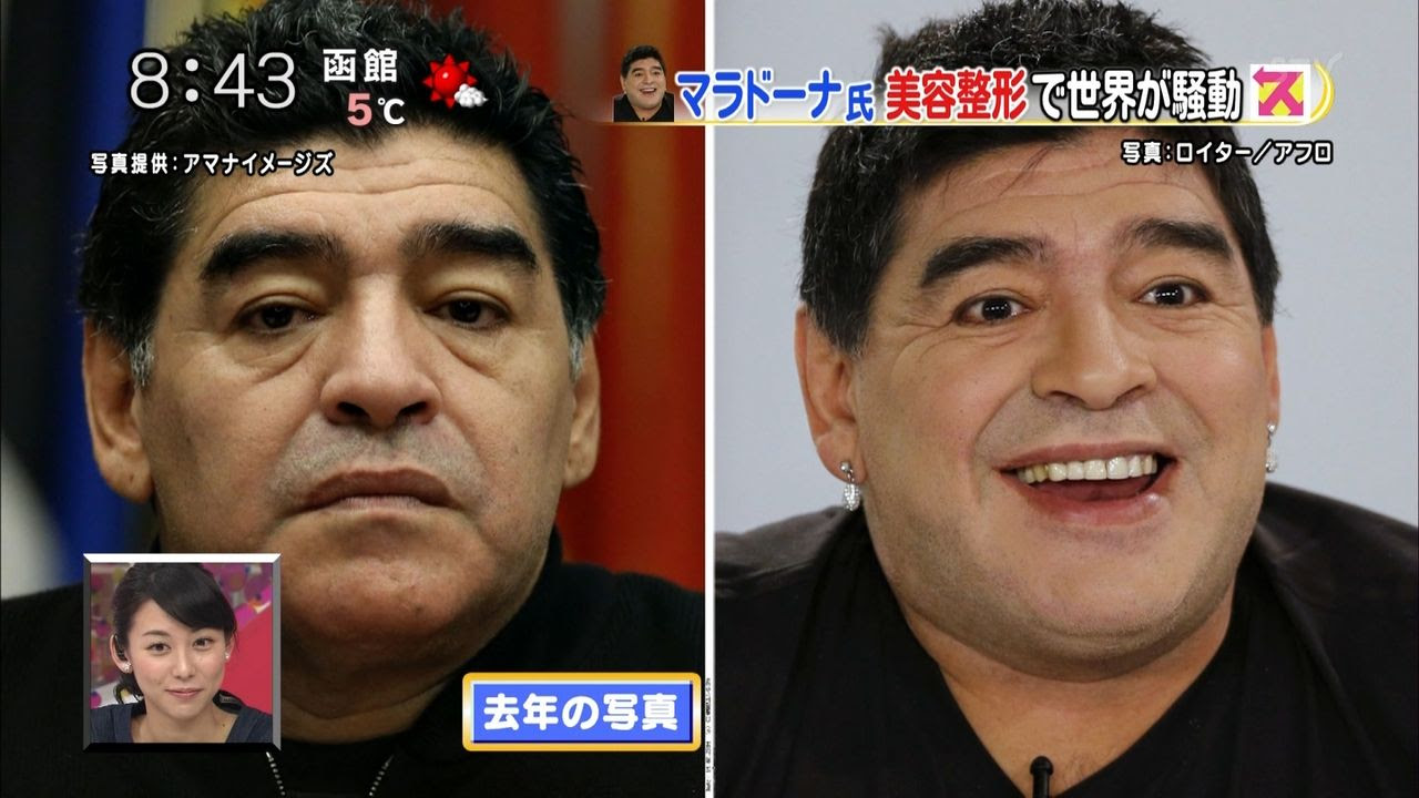 画像 美容整形手術で美しくなった元アルゼンチン代表マラドーナ氏 54 をご覧ください ２ｃｈみんなのまとめ