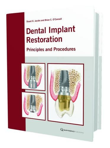 Dental Implant Restoration: Principles and ProceduresBy Stuart H. Jacobs, Brian C. O'Connell