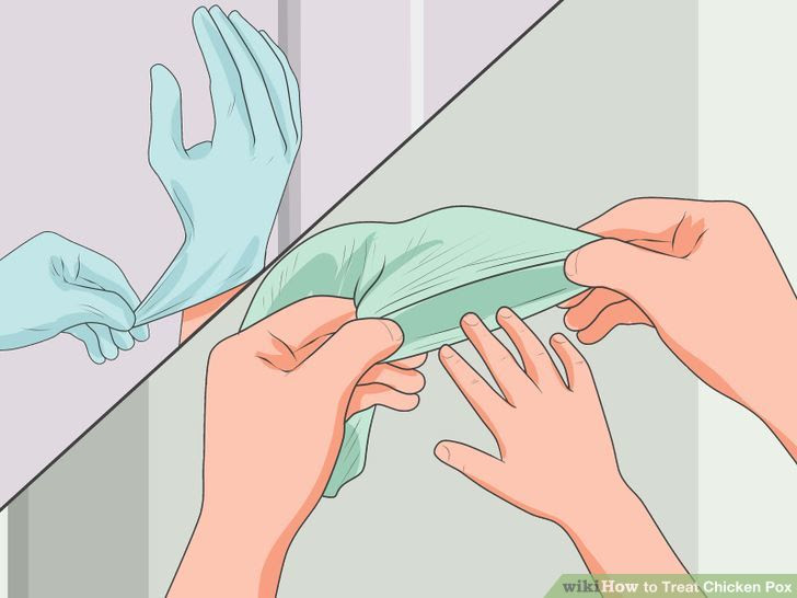 Treat Chicken Pox Step 8 Version 2.jpg