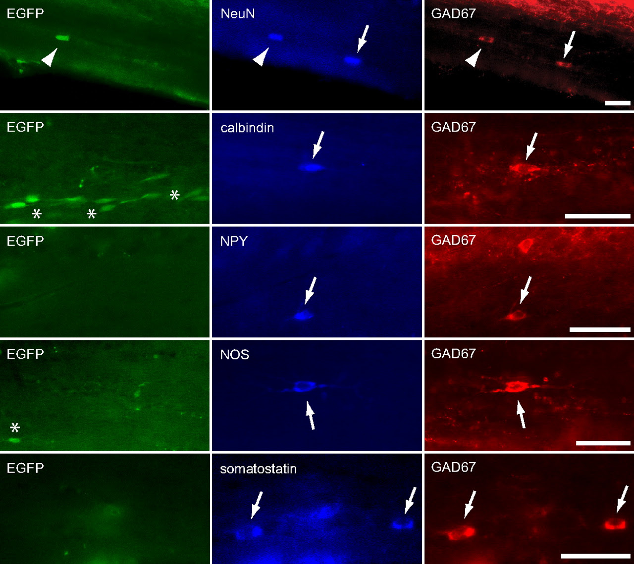 5-HT3A Receptor-Bearing White Matter Interstitial ...