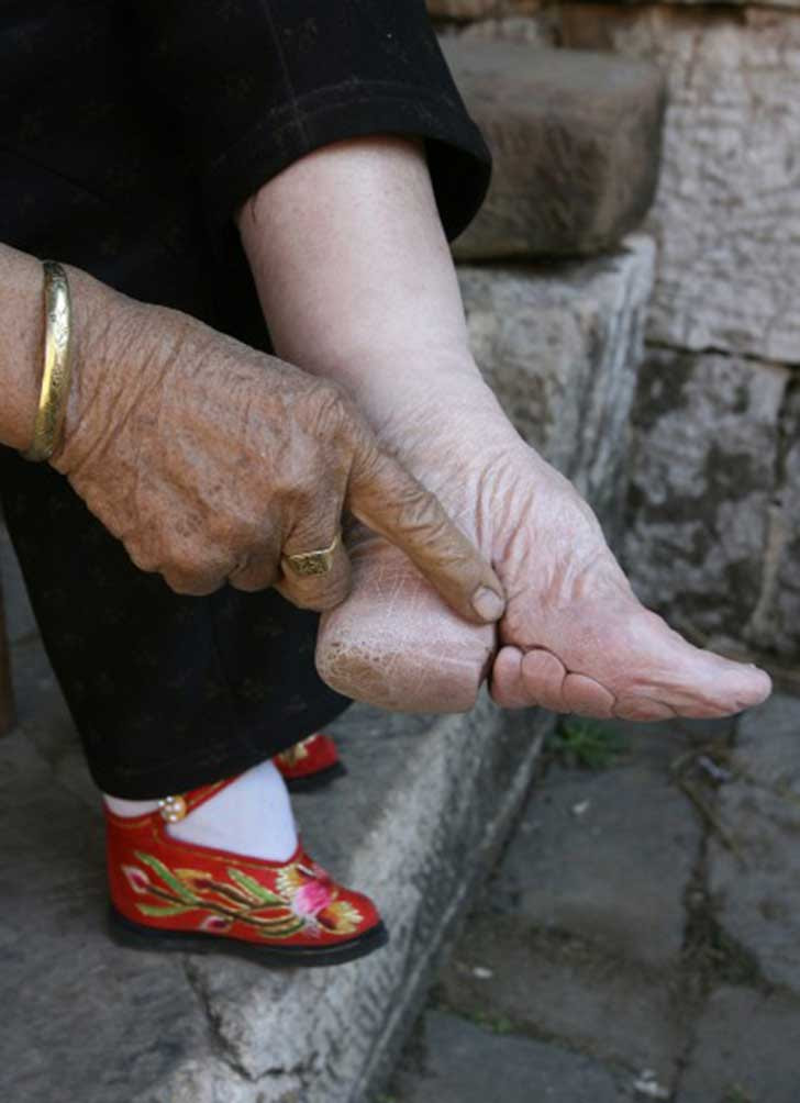 chinesefeet5