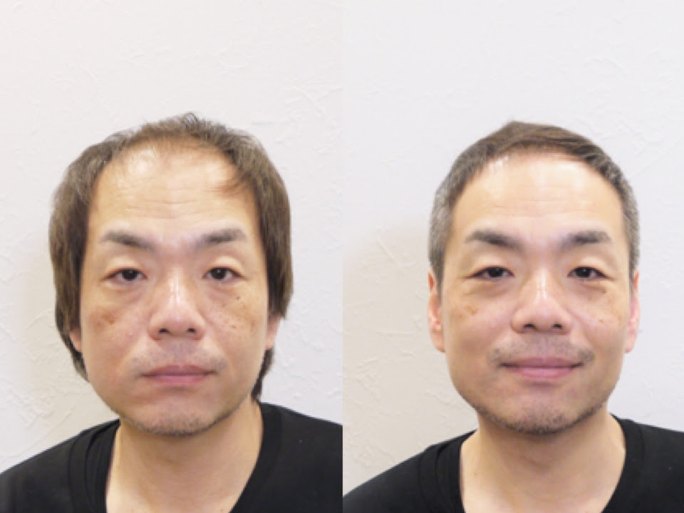 40代 男性 髪型 薄毛 Khabarplanet Com