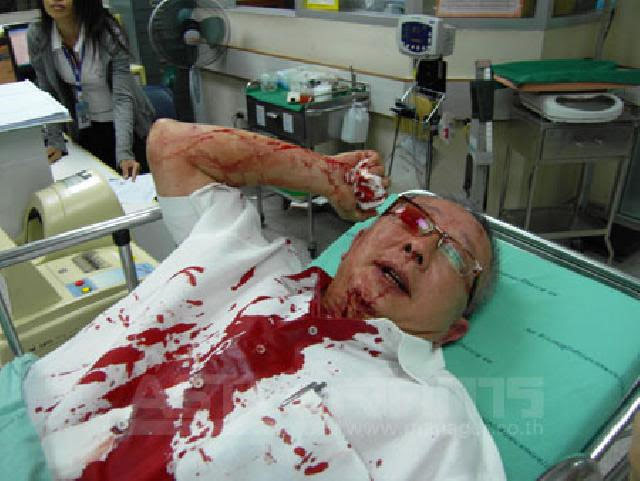 รูปภาพ