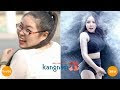 Thẩm mỹ viện Kangnam – Thay đổi chân dung – Ca sĩ Bảo Trâm