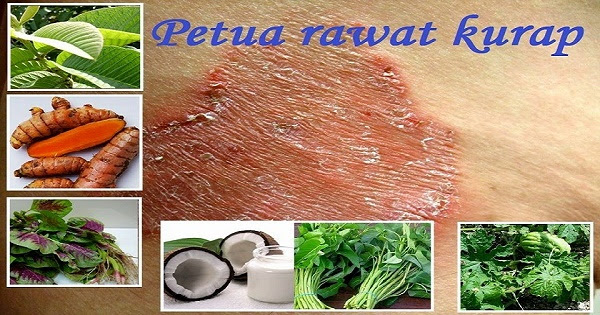 Petua Macam Mana Nak Menghilangkan Kurap Secara Semulajadi Dengan