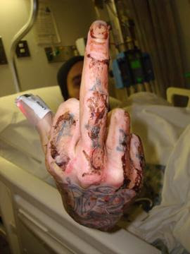 travis barker hospital