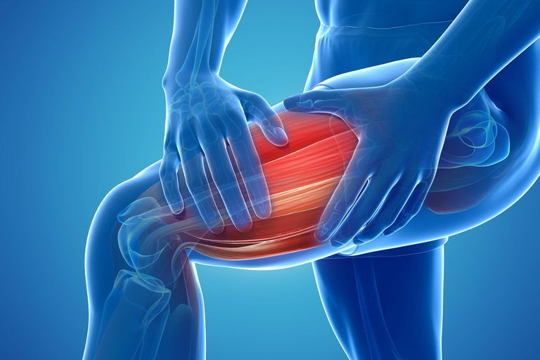 Hyperthyroidism leg pain