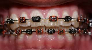 jual behel  gigi  murah