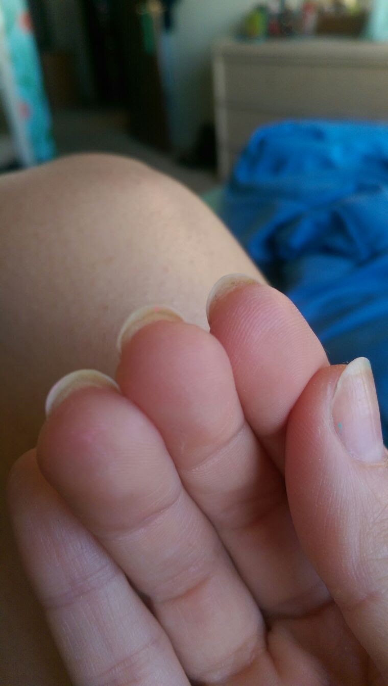 Question The Attached Skin Under My Nails Has Grown Past My Fingertip Is This Normal Tips For Care Welcome Redditlaqueristas