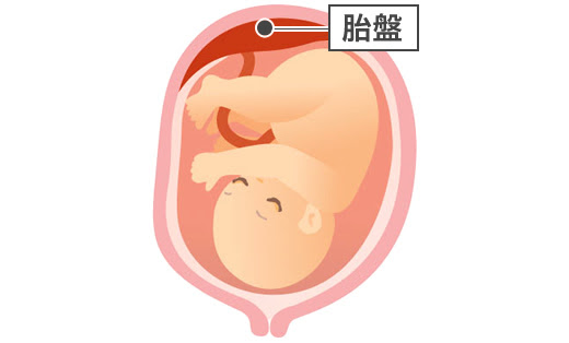 選択 予定 帝王切開が行われる主なケース 帝王切開とは 帝王切開ナビ