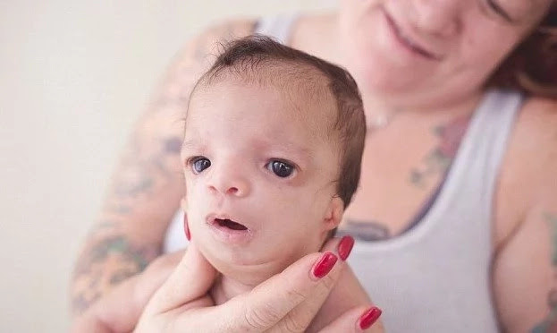 Deformed baby abandoned by adoptive parents. Her OWN REAL MOTHER decides to KEEP her (photos, video)