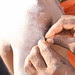 Inserting  The Skin With Needles To Hang Limes