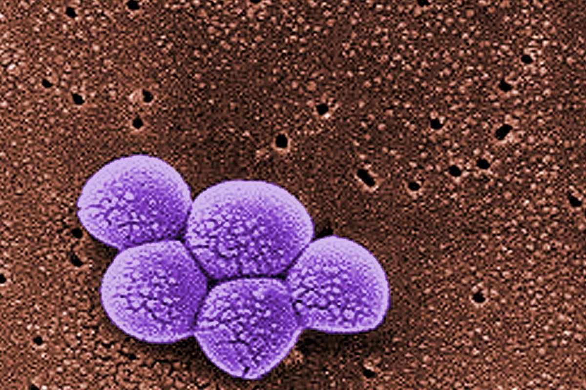 Pflanzenmedizin: Mit Algen gegen Malaria und MRSA - News ...