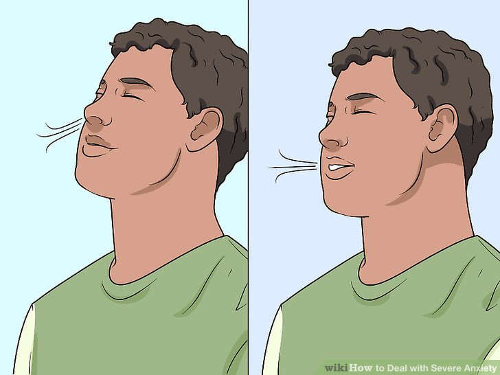 Deal with Severe Anxiety Step 2.jpg
