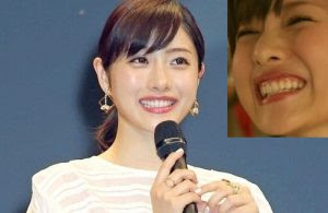 前歯が内向きは良いこと 石原さとみさんは内向き