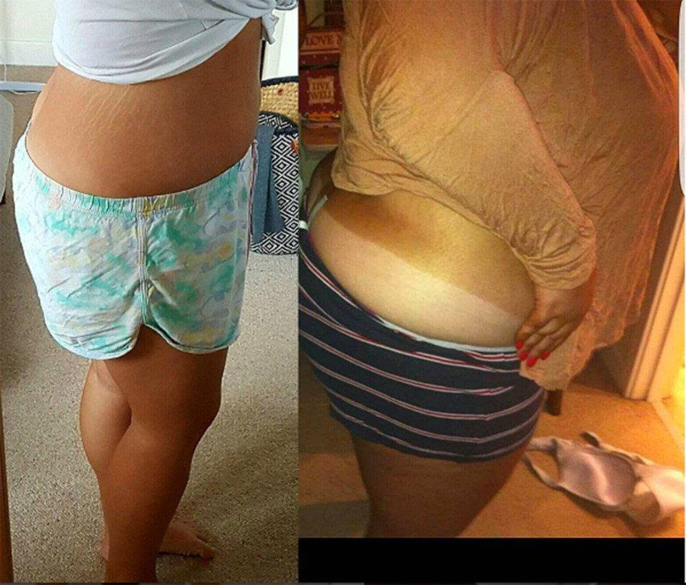 A 26-Year-Old Loses 126 Pounds and Gets Proposed To