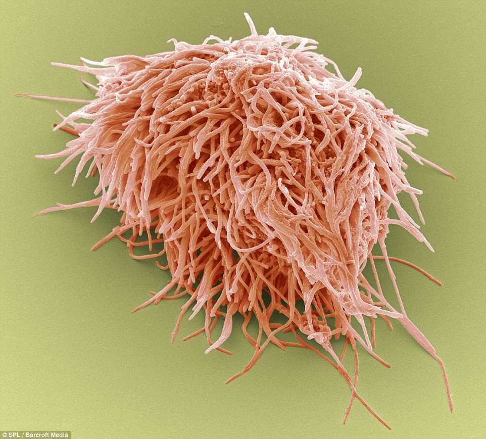 Other worldly: This may look like some sort of under-the-sea plant, but is in fact a magnified image of the plaque-forming bacteria that gathers on teeth
