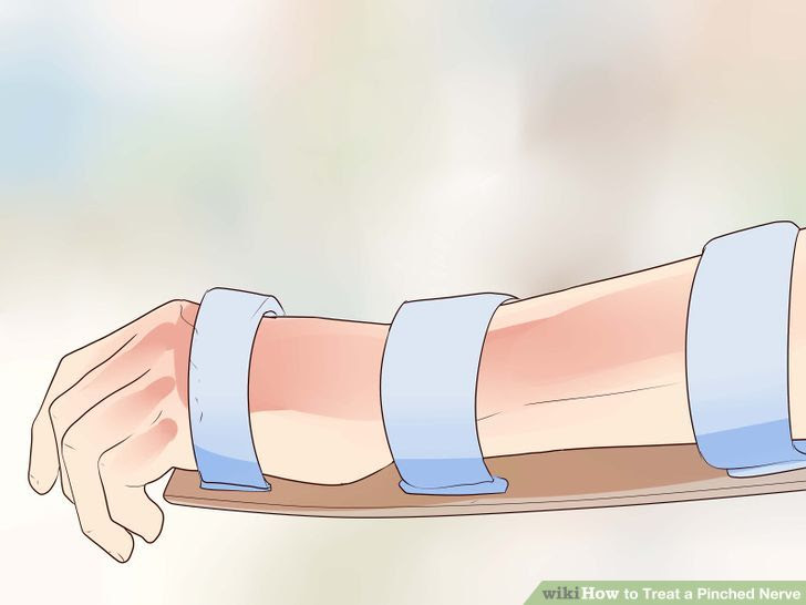 Cope With Having a Ganglion Step 5 Version 2.jpg