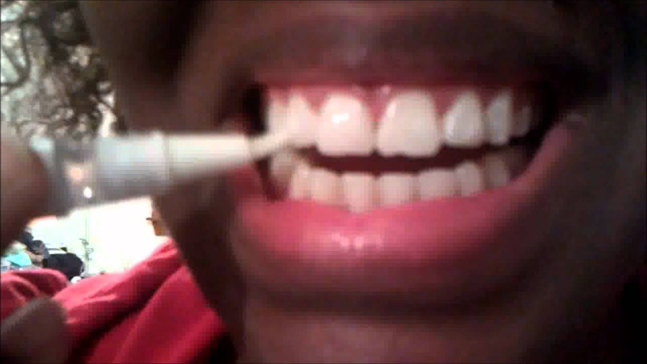 Dazzling White Teeth Whitening Gel Pen Review Day: 3 - YouTube