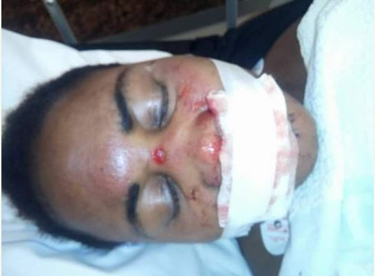 Nigerian Pastor in Netherlands Allegedly Pushes His Wife Down From Upstairs (Graphic Photos)