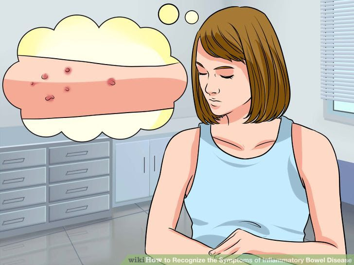Recognize the Symptoms of Inflammatory Bowel Disease Step 7 Version 2.jpg