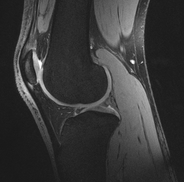 Cartilage – studying Tim’s knee – Tim Peake's Principia blog