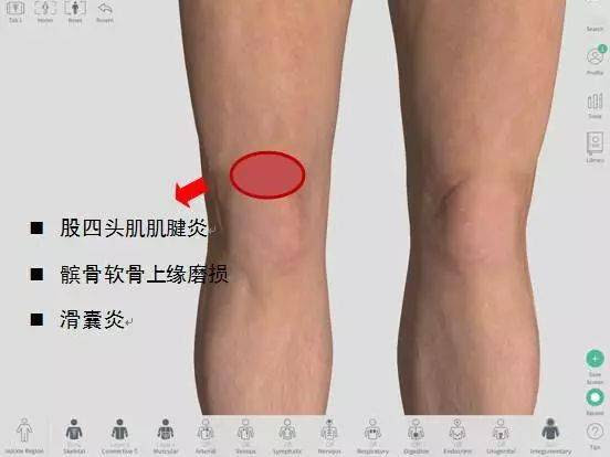 膝关节不同部位疼痛的原因及其康复 膝盖