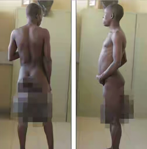 Image result for Kenyan Man With Biggest Manhood Undergoes Surgery