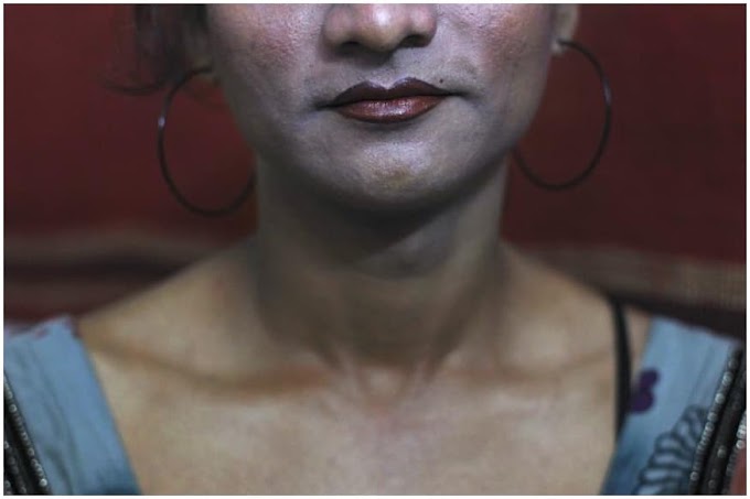 Transgender Bill Violative Not Protective: Here's Why Transpersons Are Agitating Against the New Bill