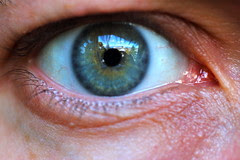 Another eye