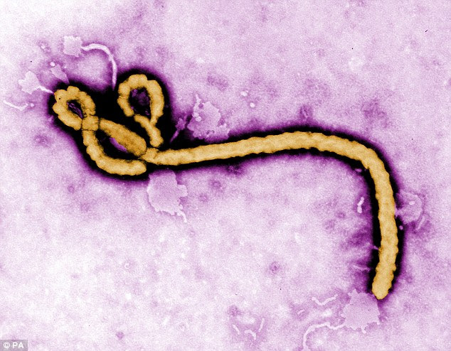 The Centers for Disease Control and Prevention (CDC) has released an image of how the Ebola virus looks