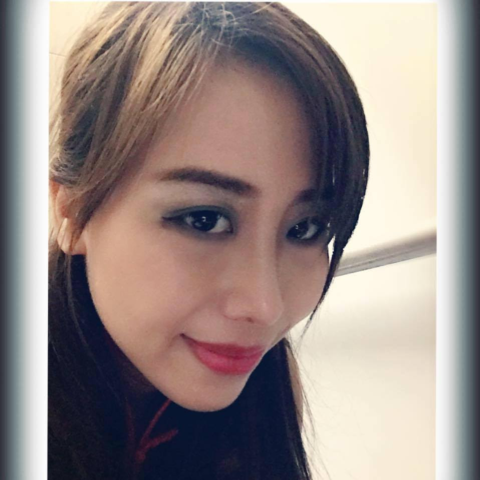 sửa mũi hỏng sau nâng 8