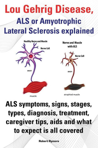 Mystery Disease