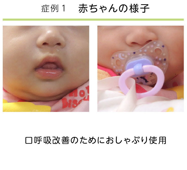 西原式 赤ちゃん豆知識 西原ワールド アート医研