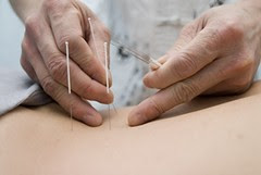The Secrets of Acupuncture to Improve Fertility Men and Women