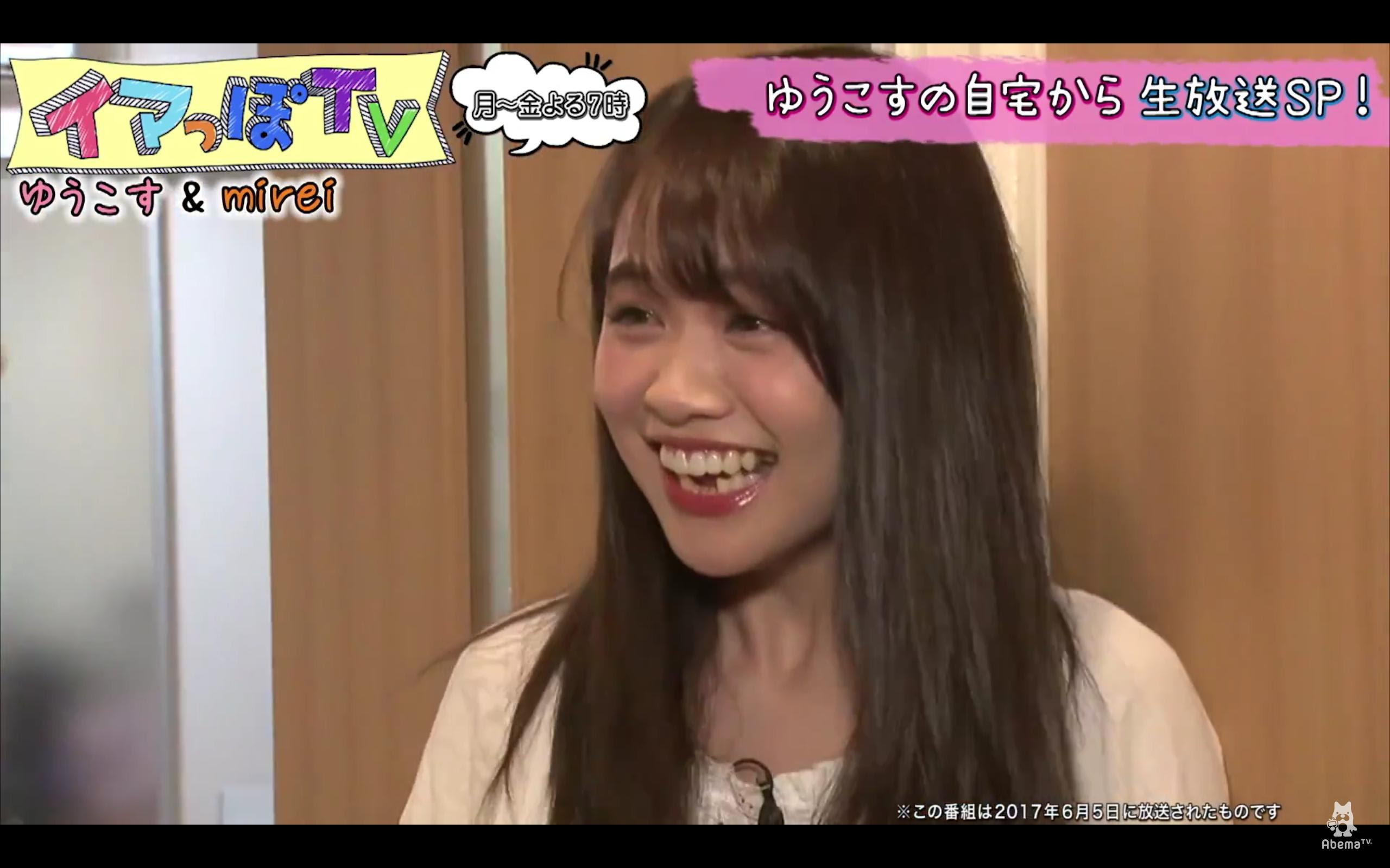 74 悲報 ゆうこす セラミック矯正 55