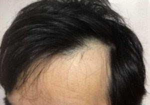 薄毛でも格好いいよ 40代メンズに似合う髪型6選 奈良斑鳩町の美容室 髪 ブログ