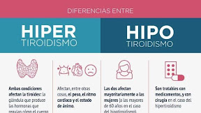 Encuentra Las 7 Diferencias Para Adolescentes / 20 increÃ­bles ideas para ahorrar espacio en una habitaciÃ³n
