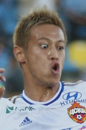 本田圭佑の目がおかしいのは病気で 現在の顔の変化がこちら バセドウ病の手術痕についても