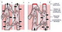 (1) Normal lymphatic flow in (a) deep systems and 