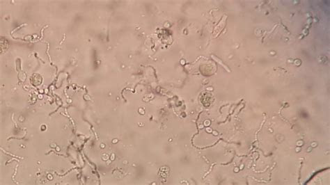 long chain bacteria yeast cell budding pseudohyphae